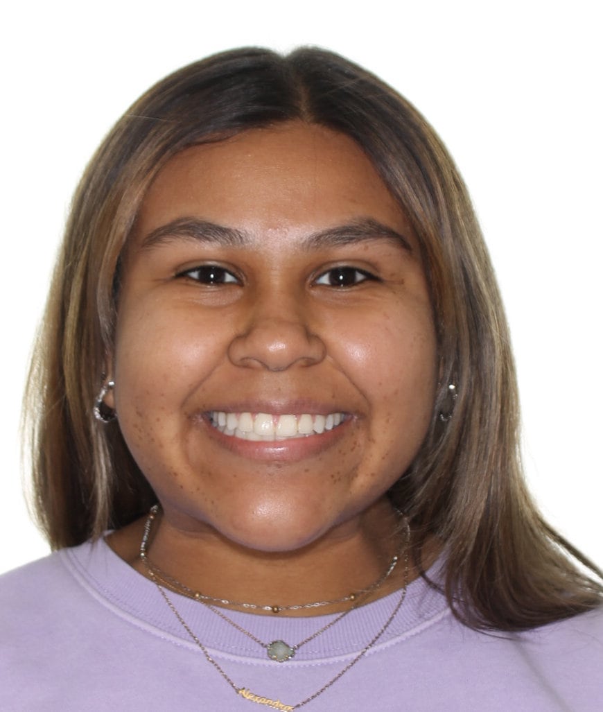 Before & Afters Oklahoma City Braces Edmond Invisalign